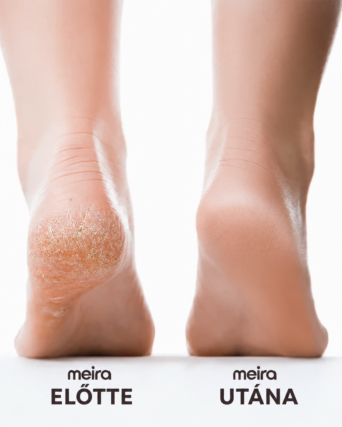 MEIRA Smooth Pro